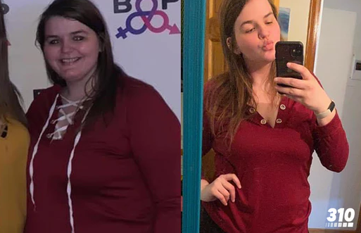 Before Weight Loss