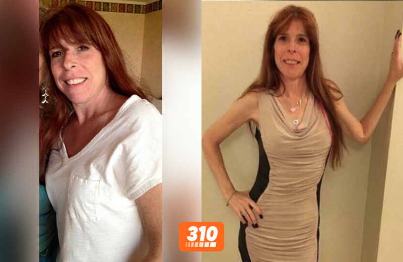 Donna McBride Ditched Unhealthy Food & Lost 30 Pounds with 310!