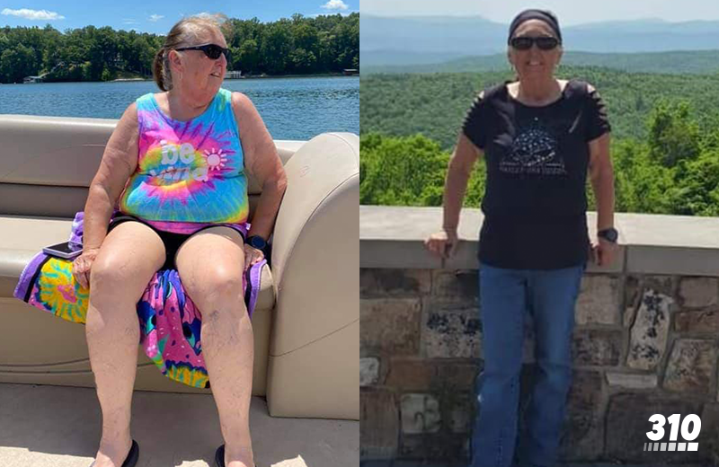losing 40 pounds weight loss transformation of Donna