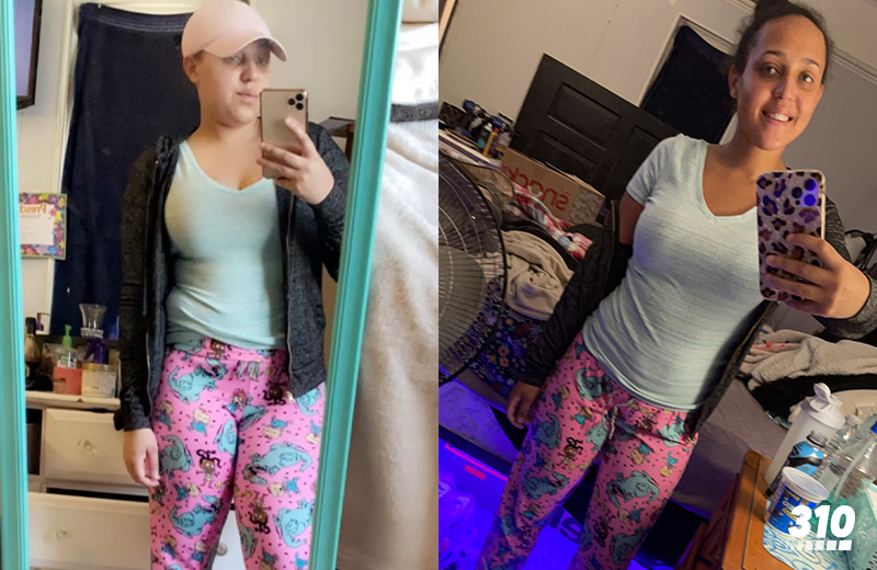 Kacey's before and after weight loss progress