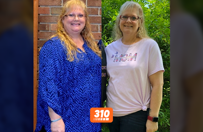 Lauri's before-and-after weight loss result