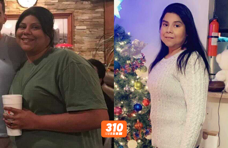 weight loss progress before-and-after photo 