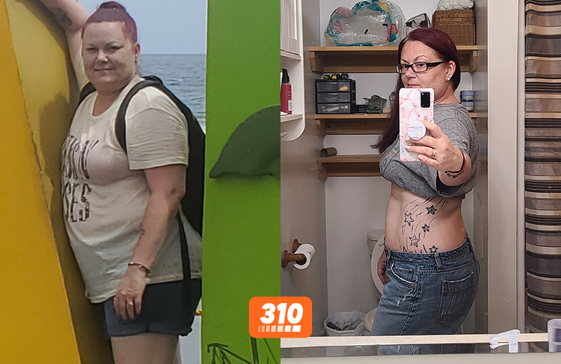 Sooner's before and after weight loss progress using 310