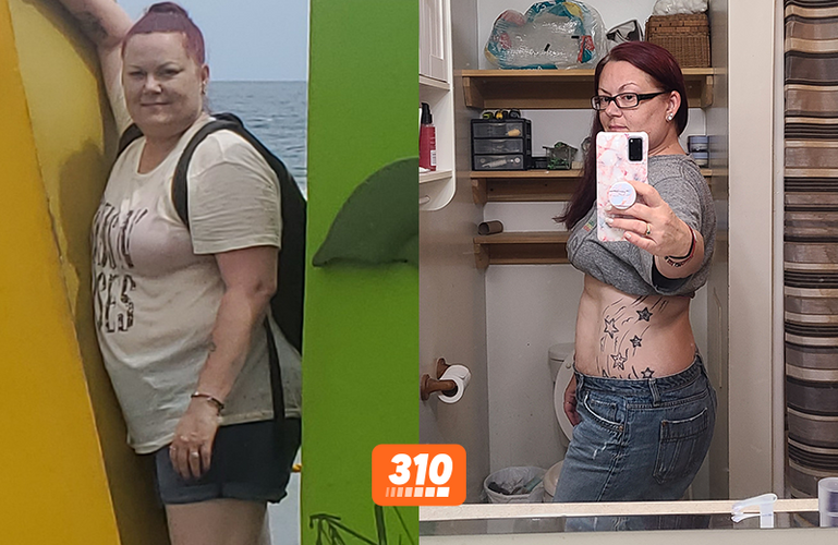 Sooner's before and after weight loss progress using 310