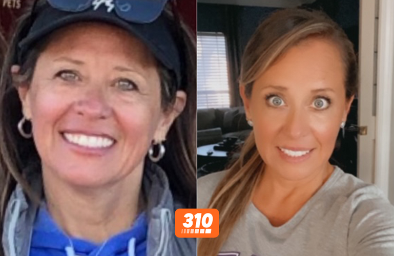 Adrianna's before and after weight loss result using 310 nutrition