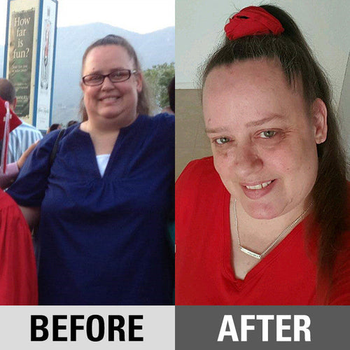 before-and-after weight loss transformation of Christine 