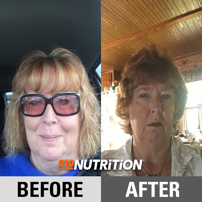 Vicki's weight loss transformation from using 310 products
