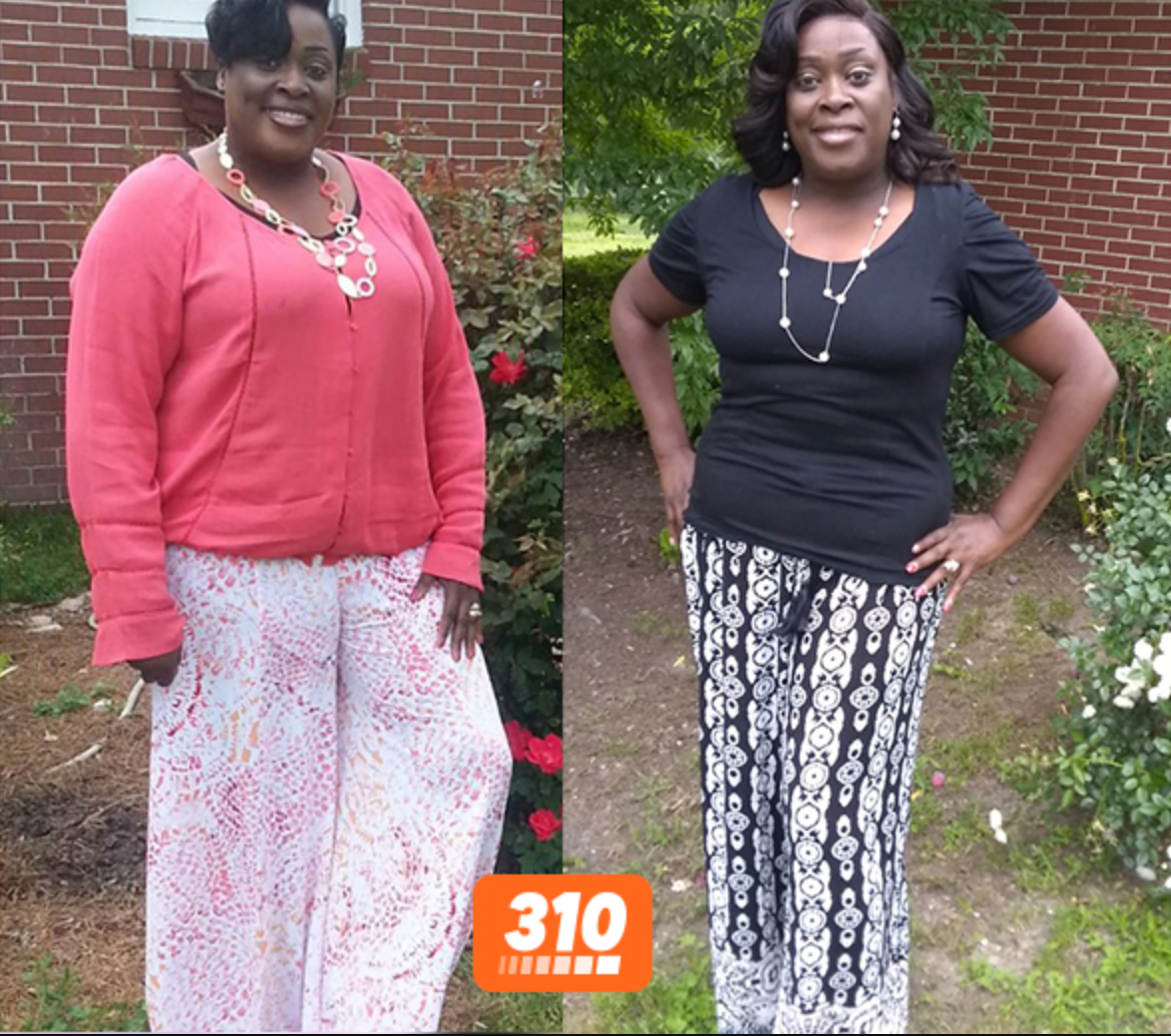 weight loss transformation of Alicia losing 310 pounds