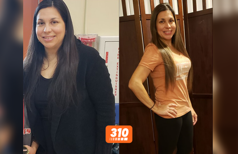 Michelle's before and after weight loss progress using 310